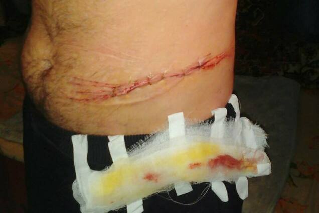 На Одесчине заключенный перерезал себе горло из-за избиений конвоиров