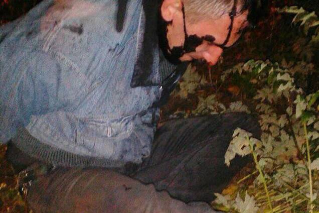 'Множество ушибов': на Одесщине расквитались с 'сепаром', осквернившим герб Украины