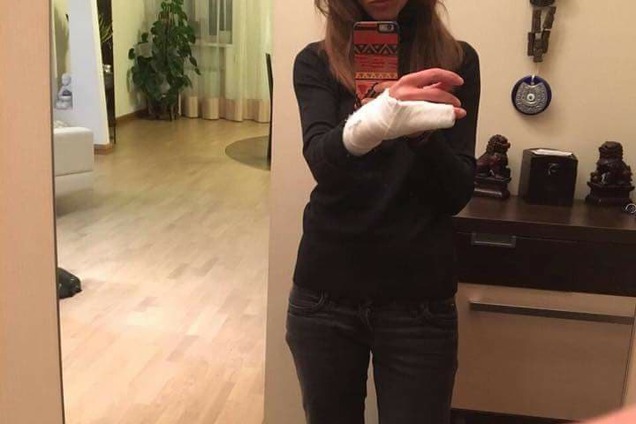 'Зламали руку': в поліції Києва показали свою версію скандалу з жінкою-водієм