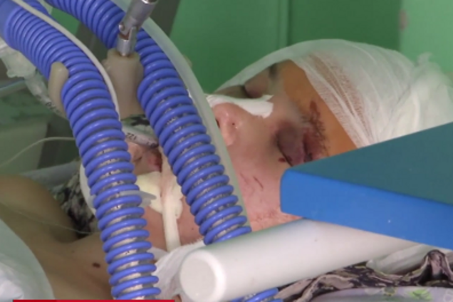 Избитая девушка