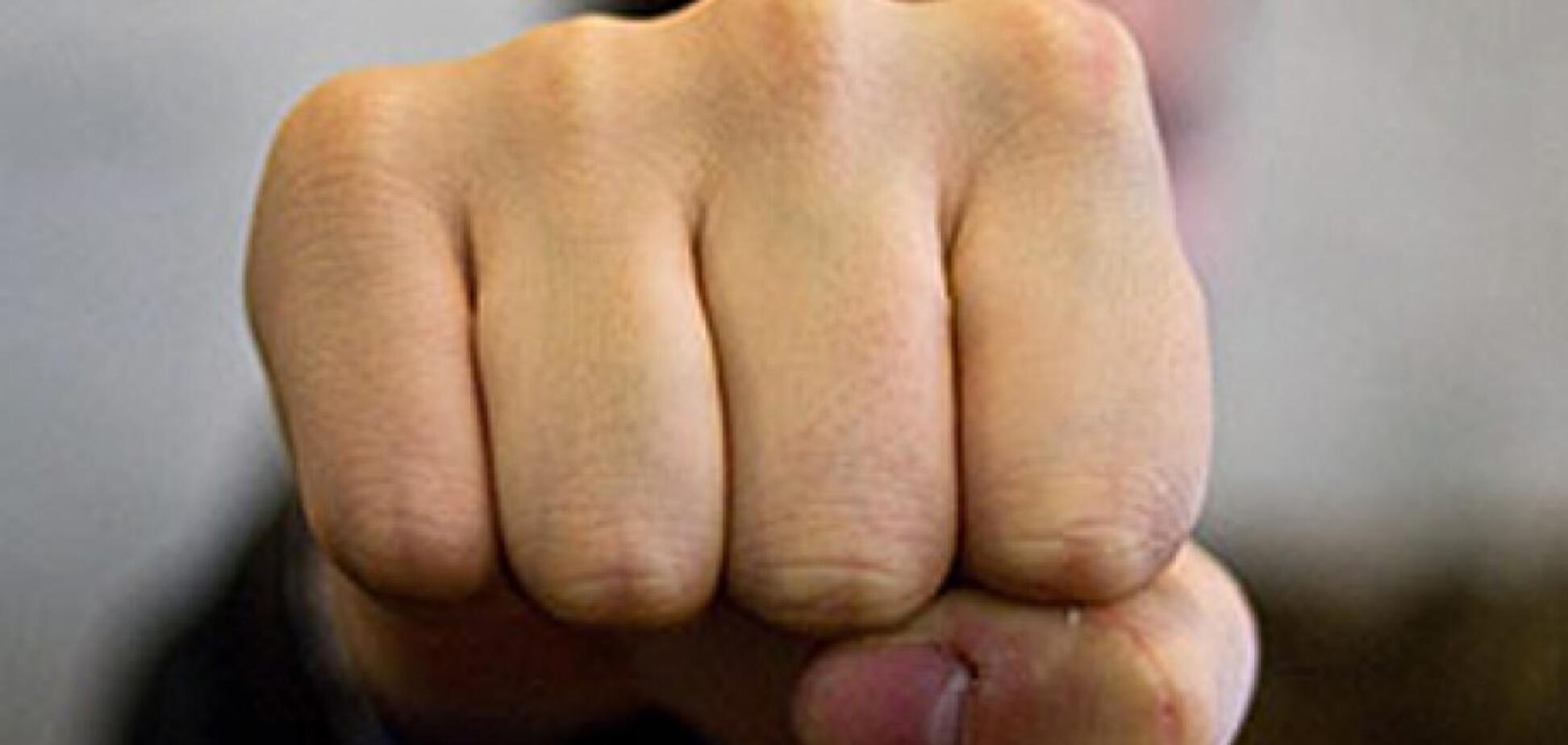 У Херсоні під час бійки чоловіку відірвали руку: моторошні подробиці