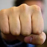 У Херсоні під час бійки чоловіку відірвали руку: моторошні подробиці