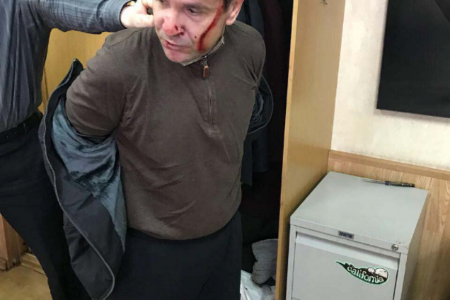 Не русский: всплыла неожиданная информация о нападавшем на Фельгенгауэр