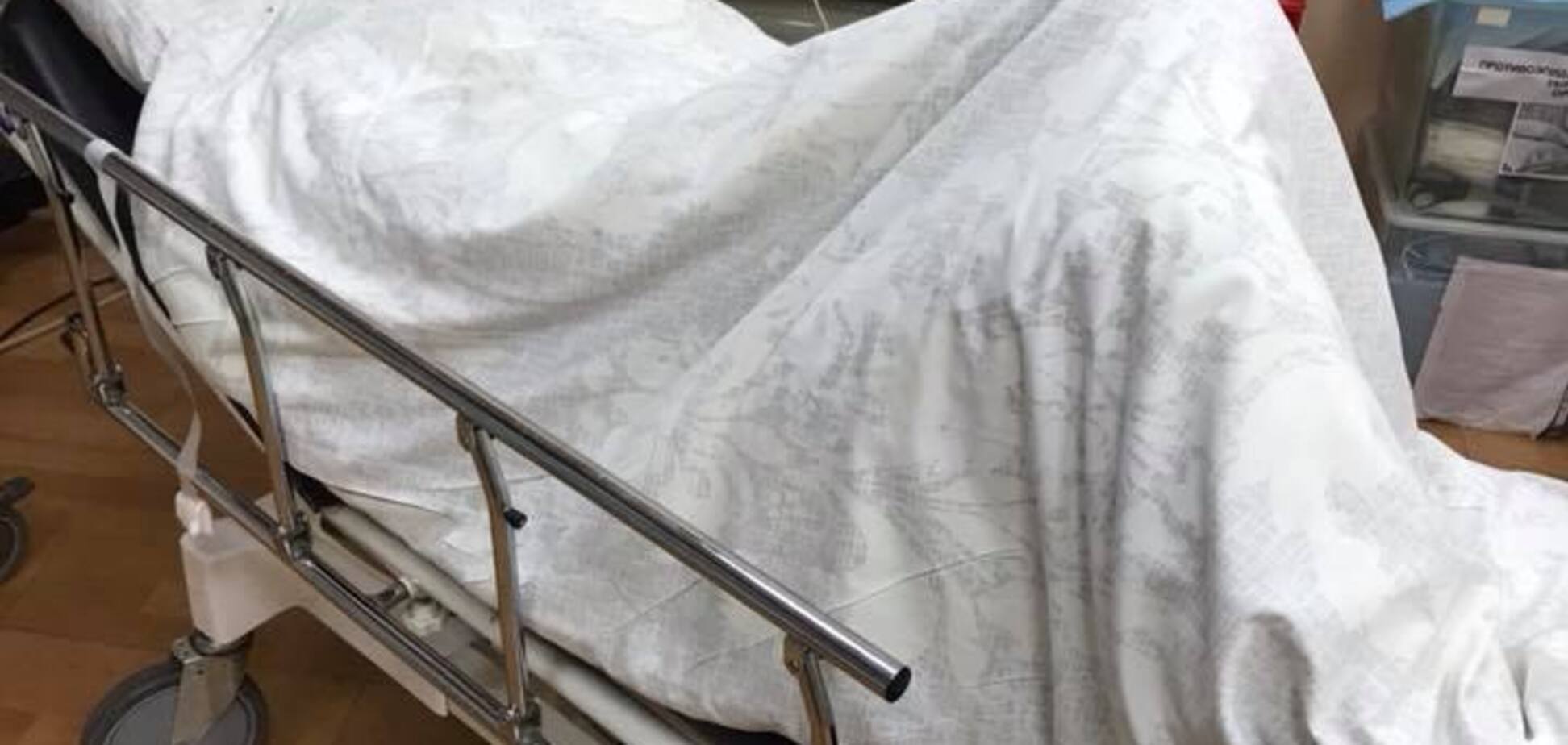 Покушение на Мосийчука: появились фото раненого нардепа
