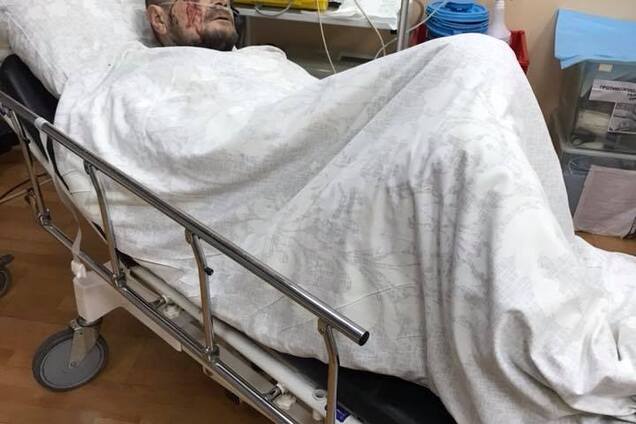 Сомнений нет: Ляшко сказал, кто совершил покушение на Мосийчука