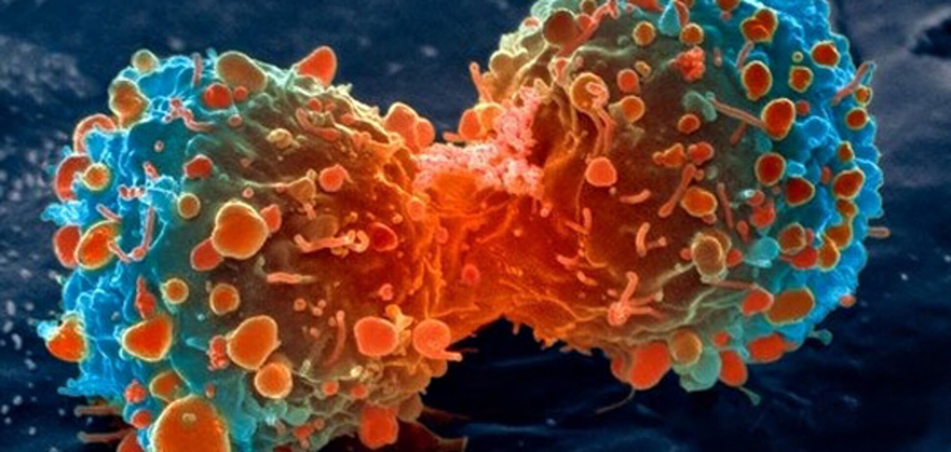Вчені відкрили нову властивість ракових клітин
