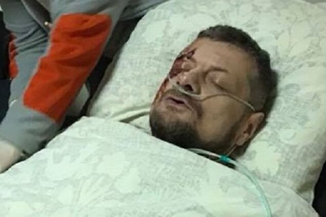 Могли и националисты: эксперт озвучил версии покушения на Мосийчука