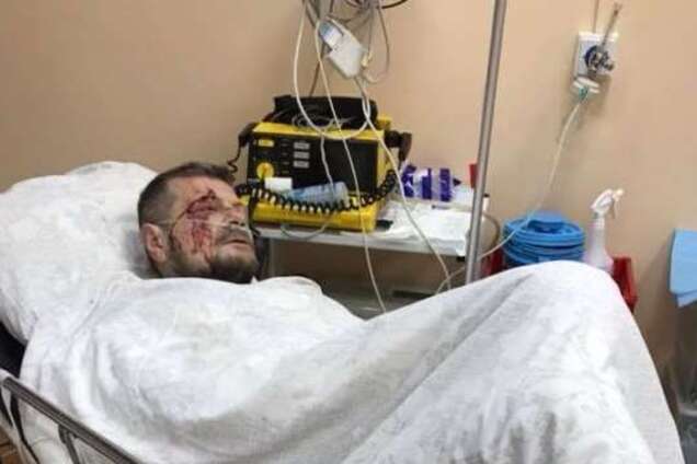 Страшный теракт в Киеве: должны последовать ответные меры