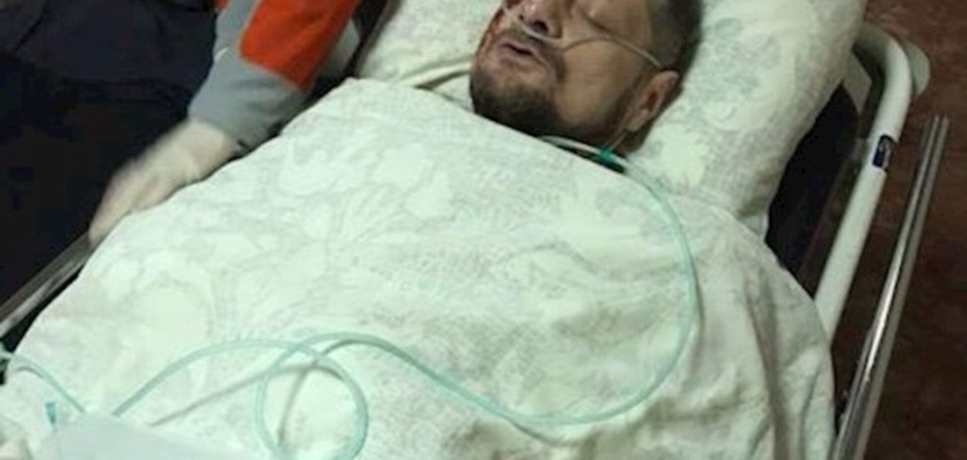 'Достали 40 осколков': Мосийчук рассказал новости о своем состоянии