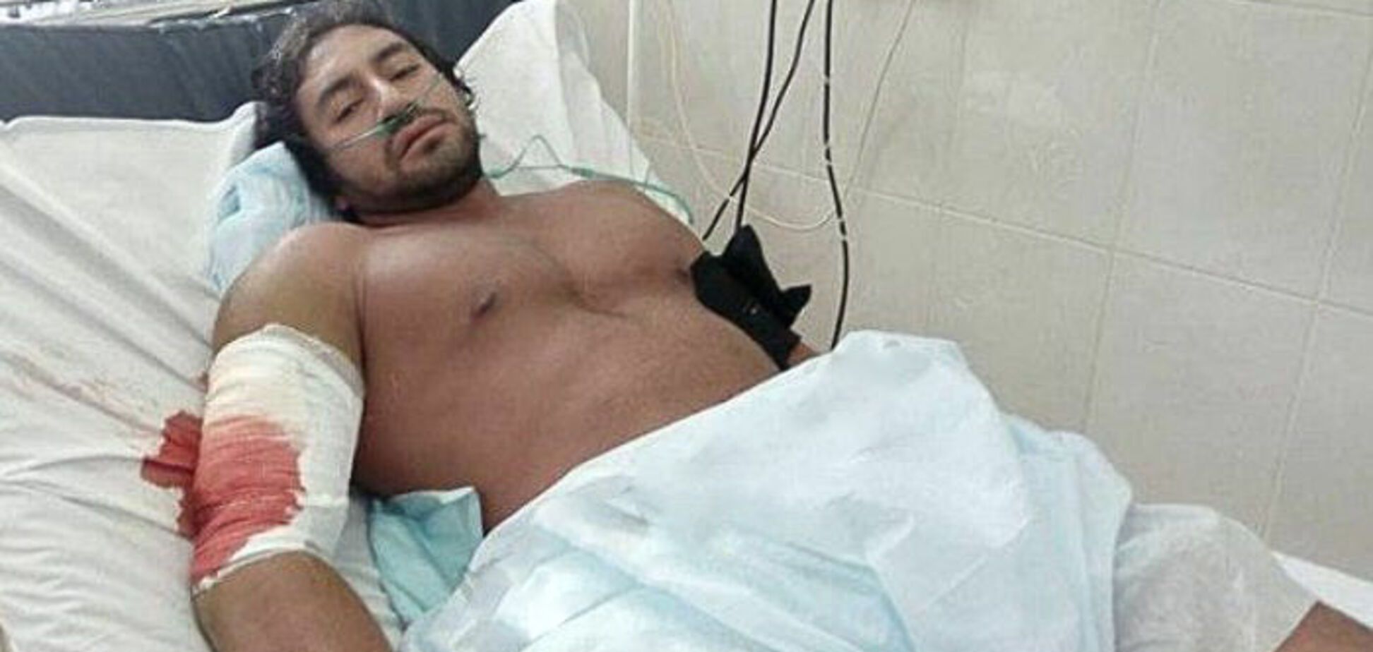 Перспективний колумбійський бодібілдер помер у Росії, отримавши подряпину на тренуванні