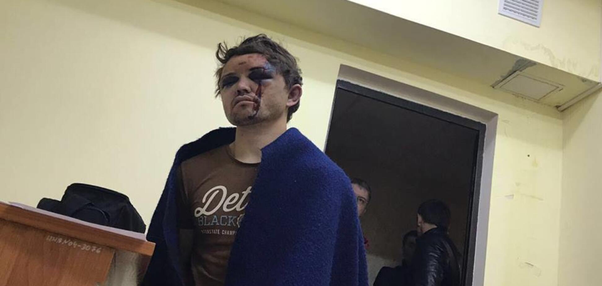 Чеченцы граница Украины