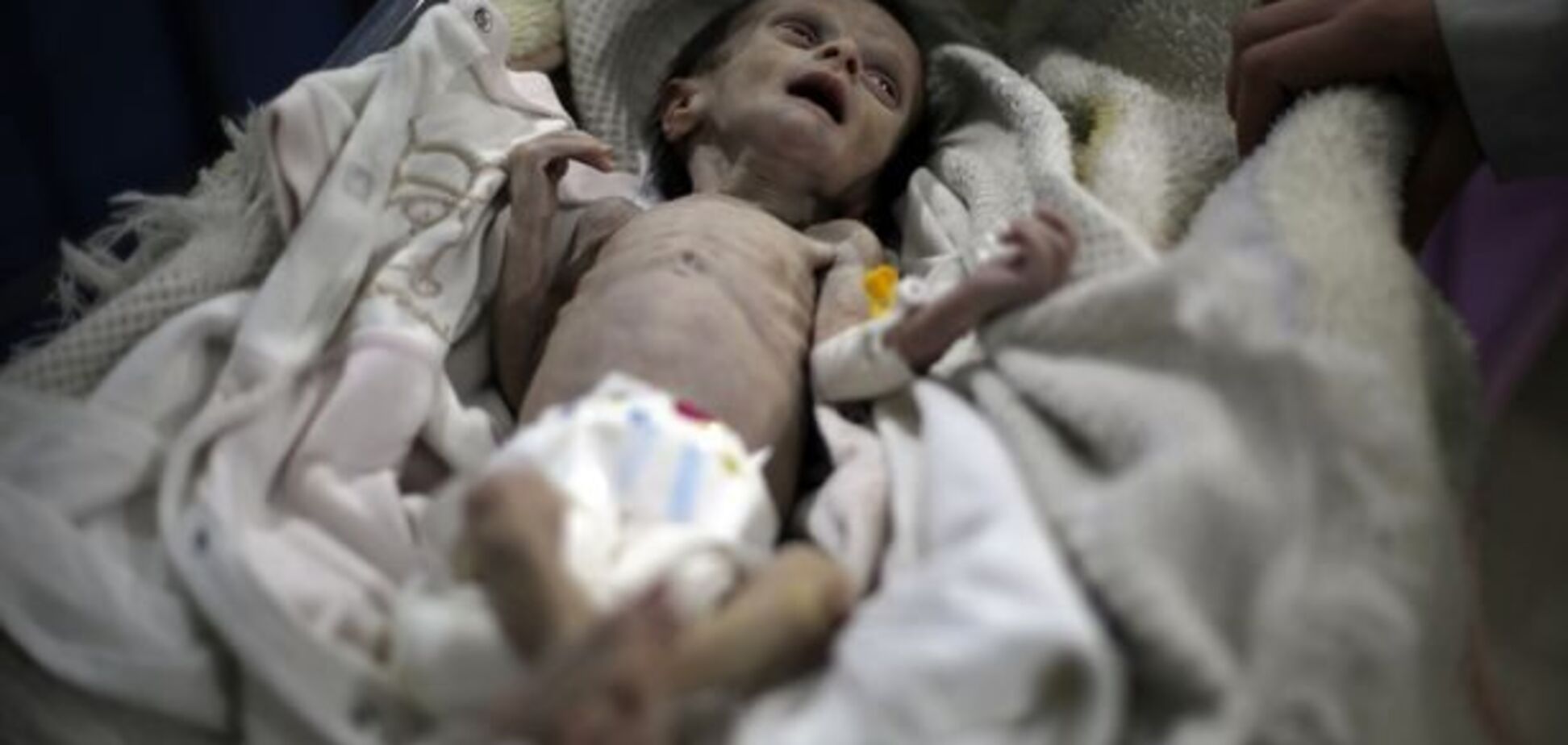 'Напоминает куклу из фильма ужасов': сирийский мальчик стал новым символом войны