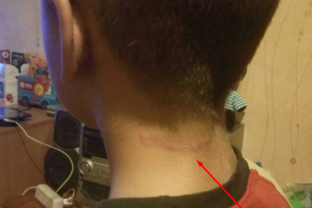 'Таскала за шею': в школе Киева вопиющий скандал с учителями