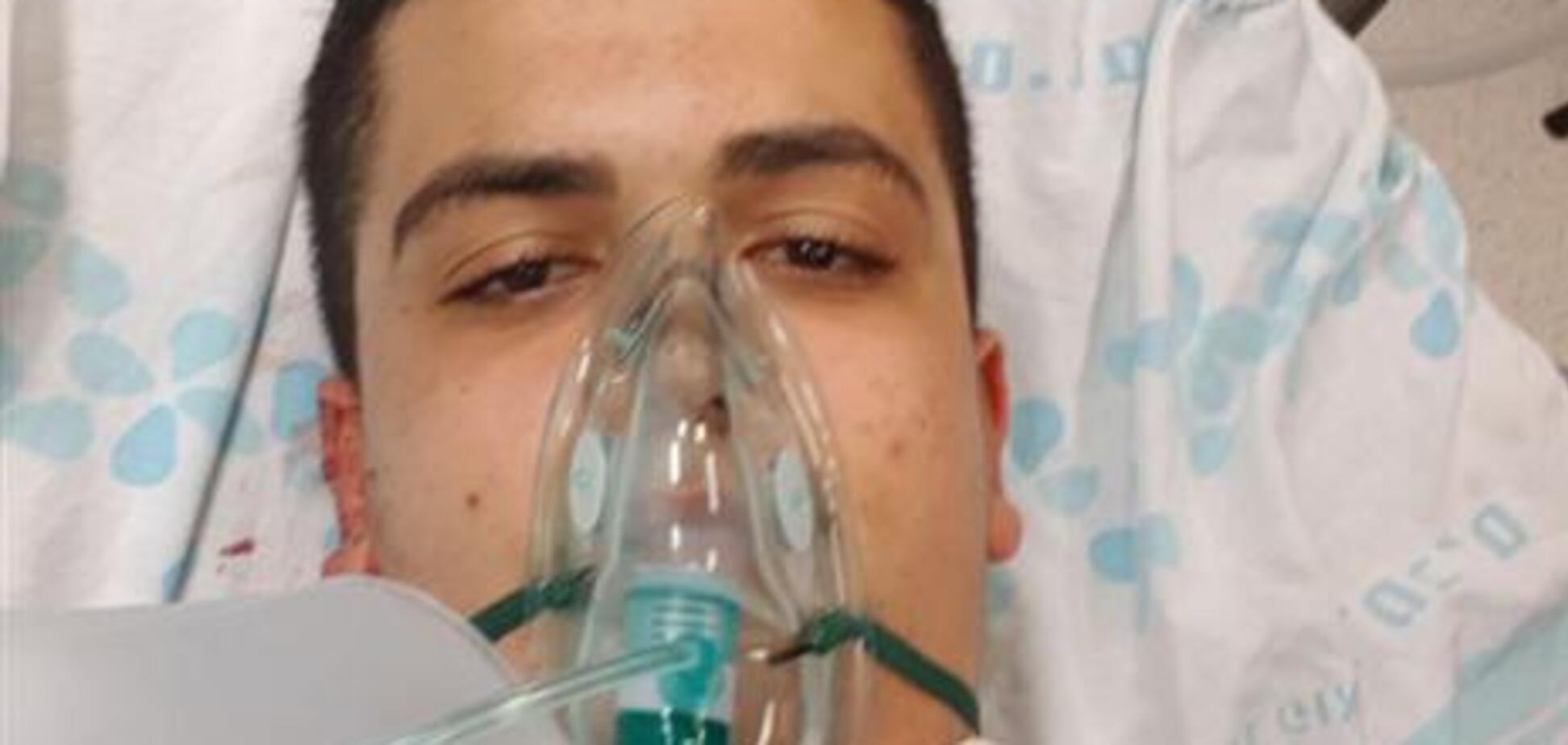 Під час матчу баскетболіст врізався у вікно, розрізавши шию