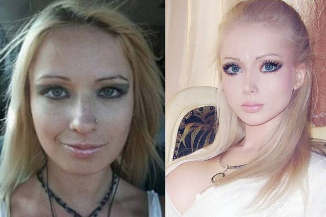 Украинская Барби: как она выглядела до пластики и после