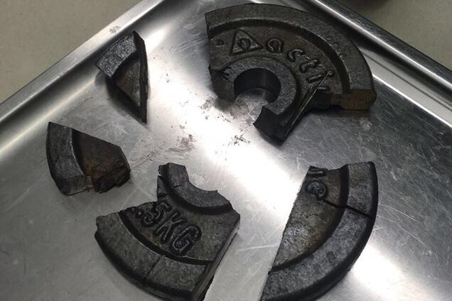 Історія із застряглим пенісом у млинці для штанги отримала продовження: фото 18+