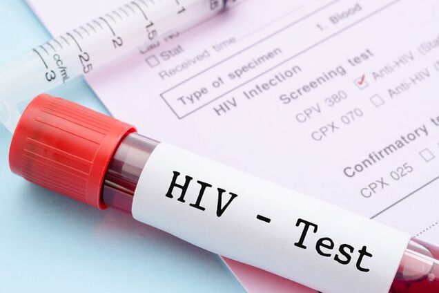 Запорожцы смогут пройти анонимный тест на ВИЧ