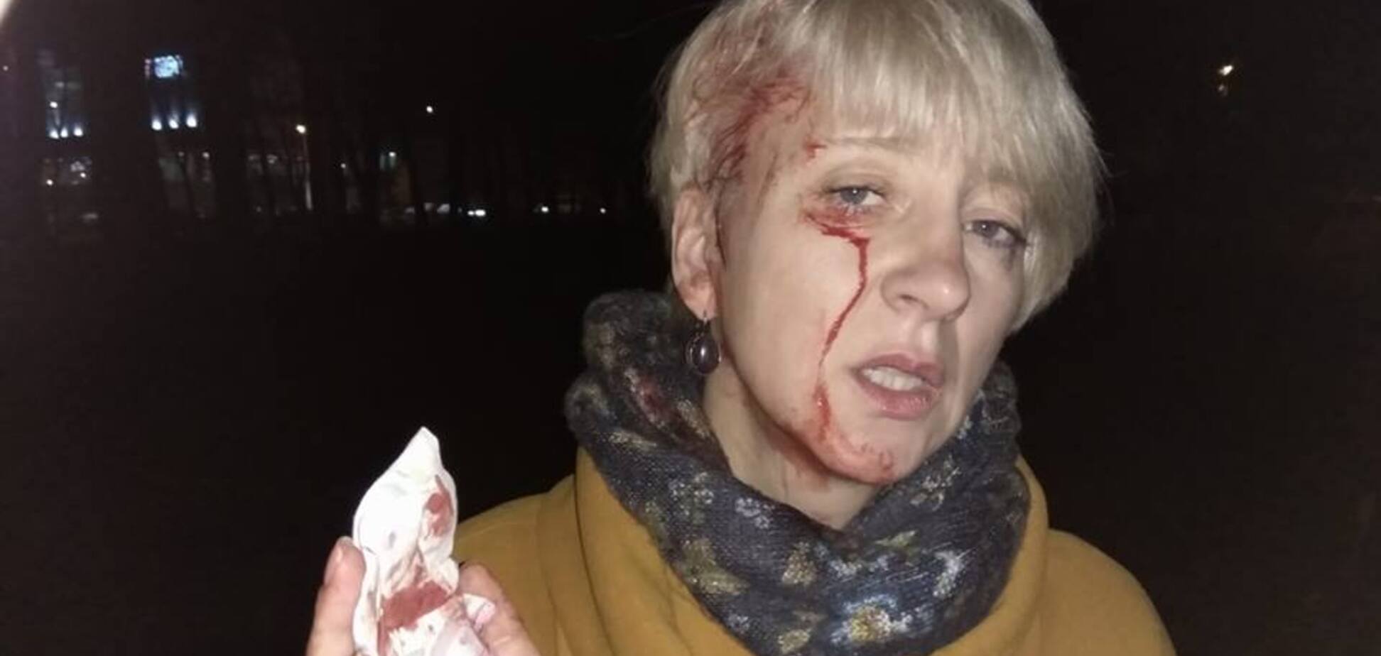 У Полтаві побили суддю, відому гучними викриттями: з'явилися фото і відео