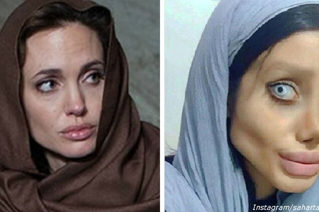 Как Джоли: иранка изуродовала лицо ужасной пластикой