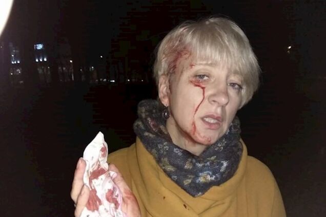 Ударил в район сердца: жестоко избитая в Полтаве судья заявила о новом преступлении