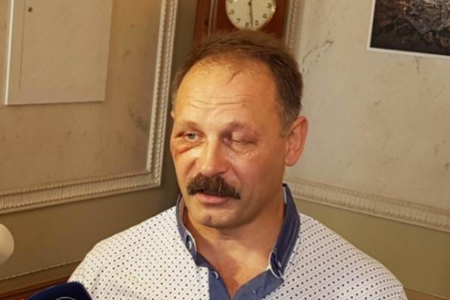 Предприниматель обвинил скандального нардепа БПП в избиении