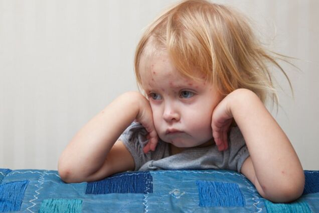 Дети оказались в больнице: в Луцке вспышка опасного заболевания