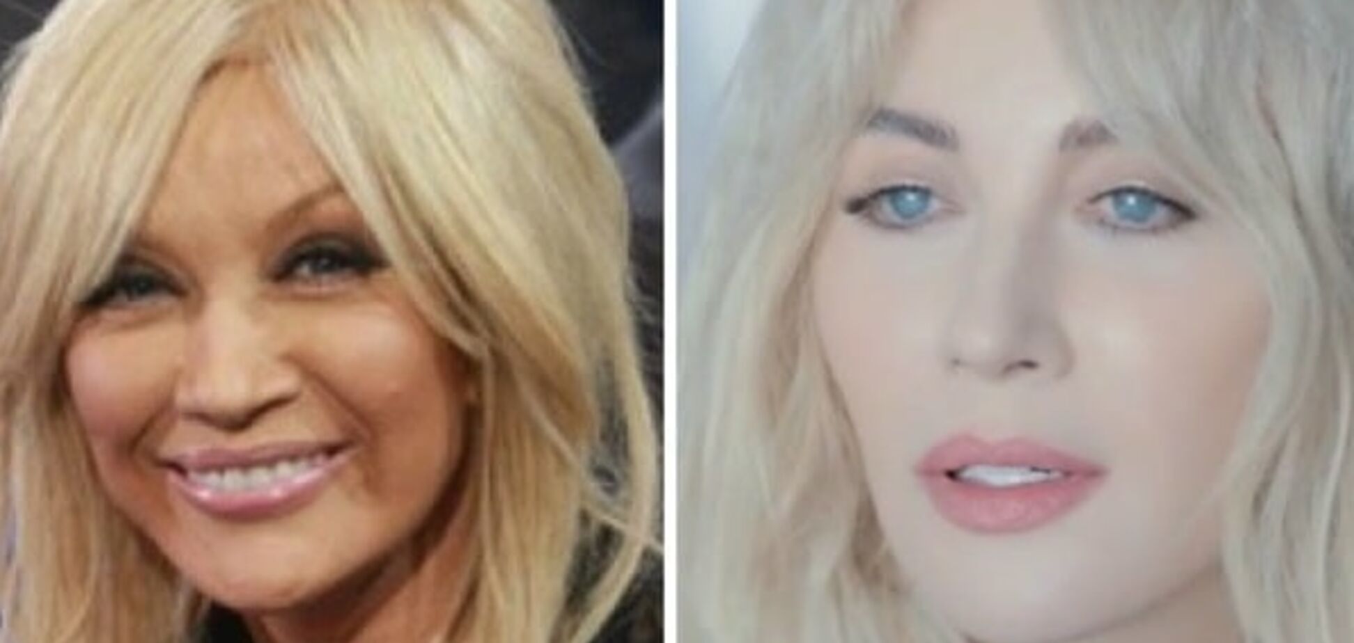 Таисия Повалий: как она выглядела до пластики и сейчас