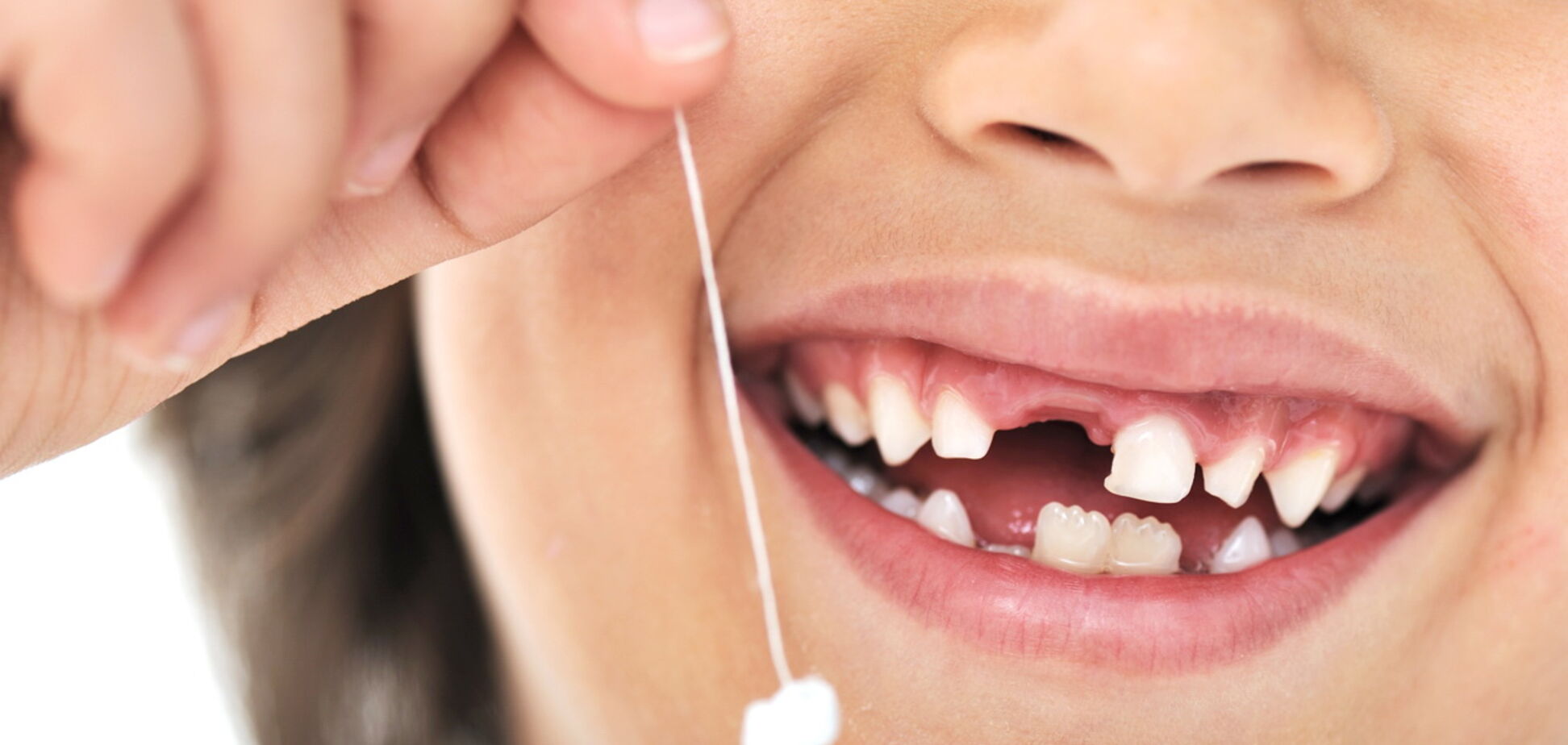 Трескаются и искривляются: доктора назвали опасный продукт для детских зубов