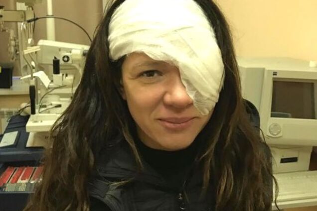 Народная артистка Украины показала, как выглядит после тяжелой операции на лице