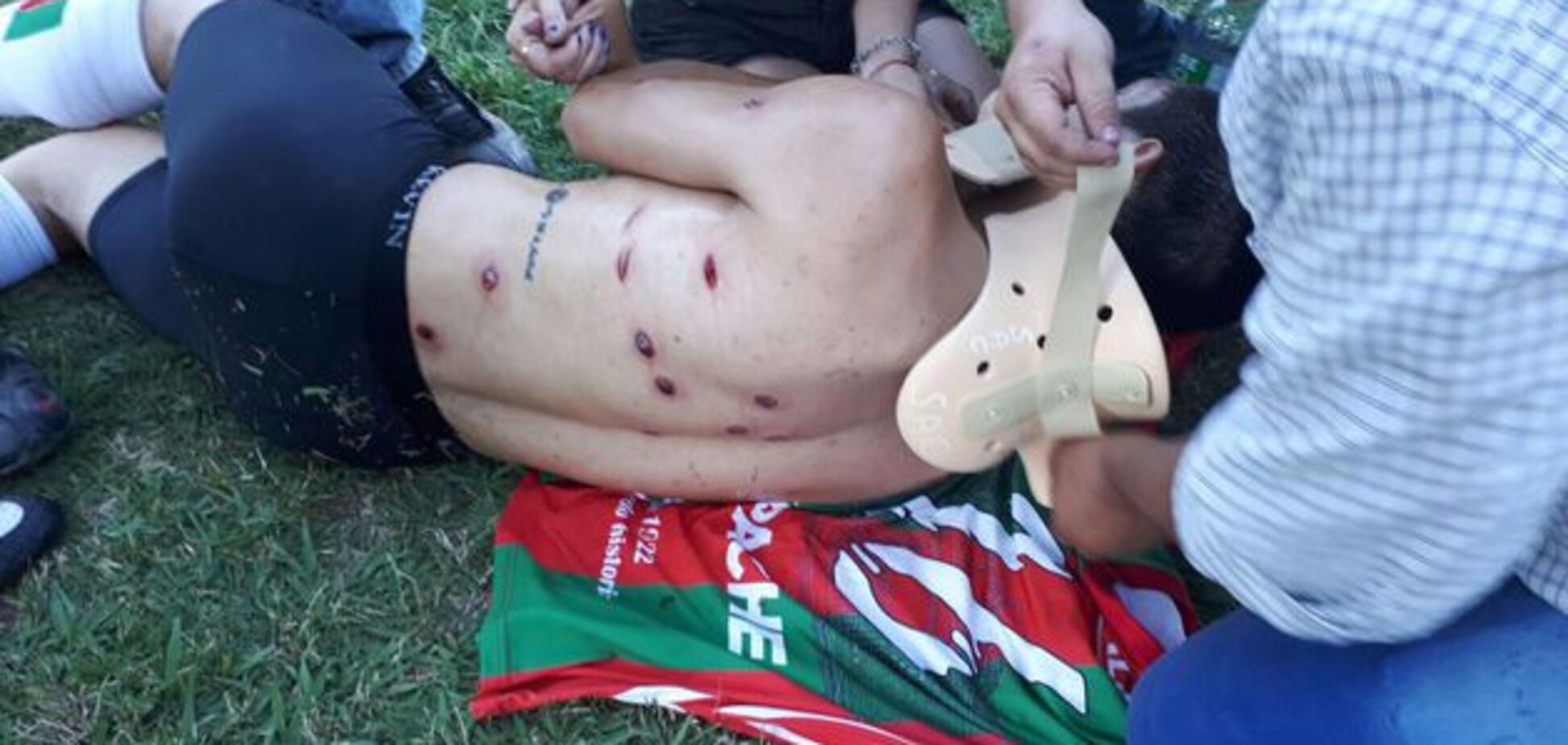 Поліція в Аргентині розстріляла футболістів під час матчу: моторошні фото поранених