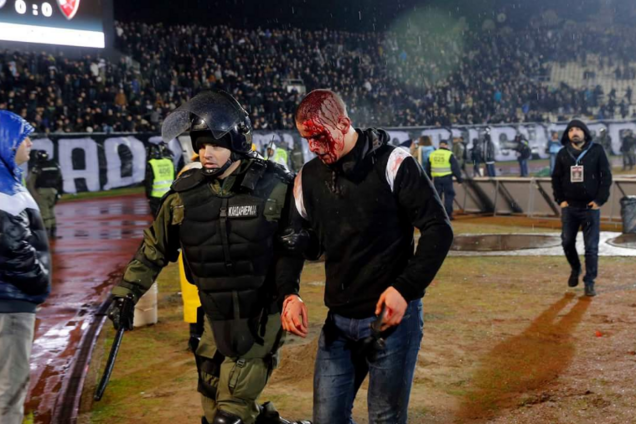 Матч чемпіонату Сербії з футболу перетворився в криваву бійню: з'явилися моторошні фото
