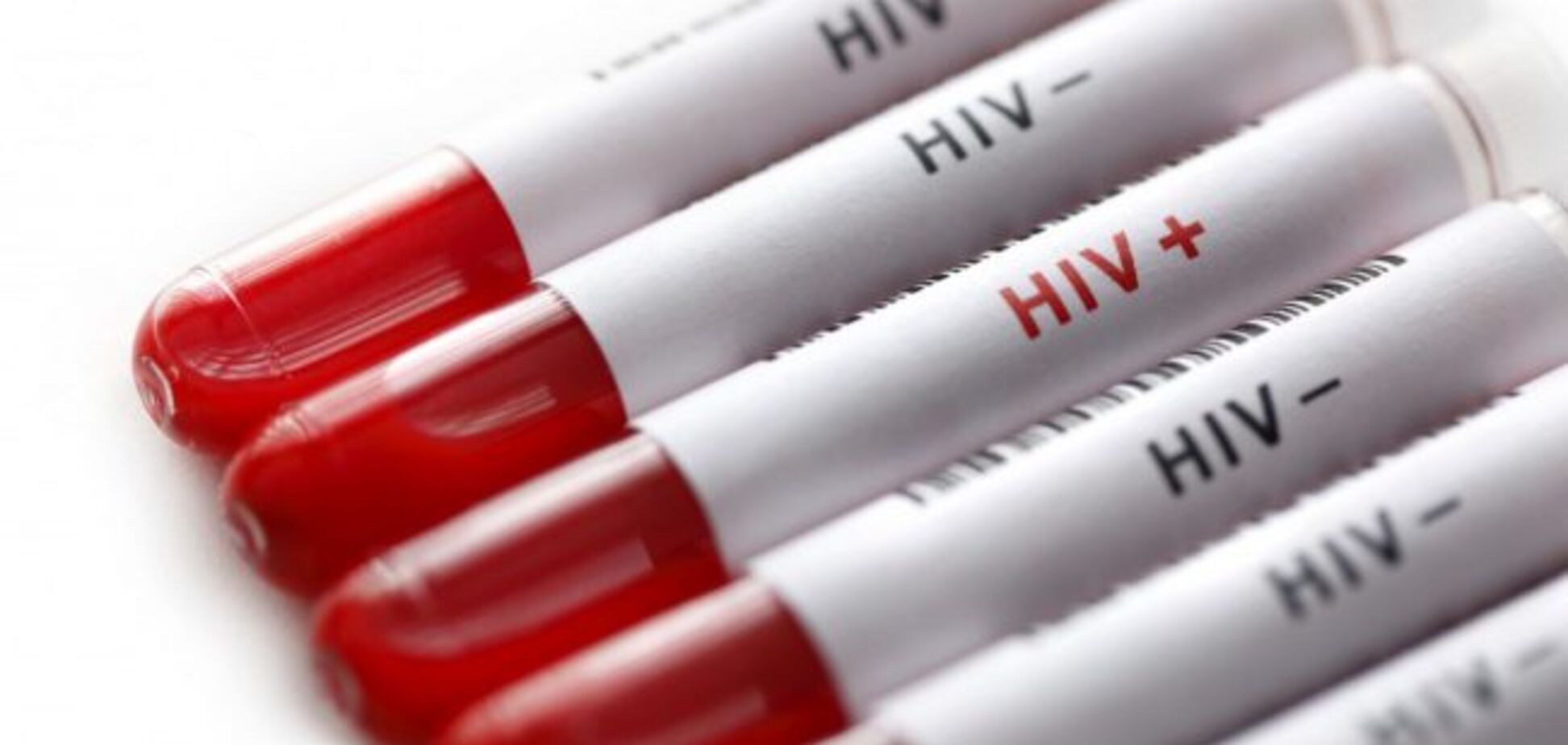 Вчені створили препарат, що пригнічує ВІЛ
