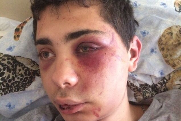 'Затянули в драку': в Сумах охранники ночного клуба зверски избили 22-летнего парня