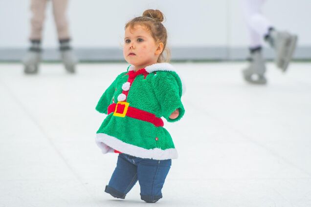 Удалили руки, ноги и часть носа: чудом выжившая малышка поразила мир