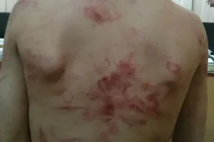 У Вінниці матір побила 7-річну дитину ременем