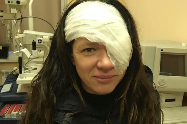 Известная украинская певица перенесла сложную операцию на лице