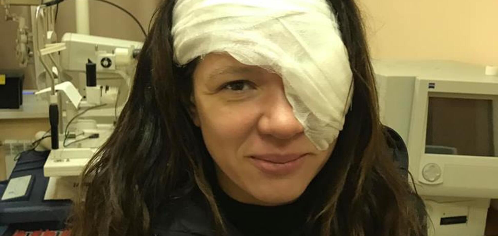 Відома українська співачка перенесла складну операцію на обличчі