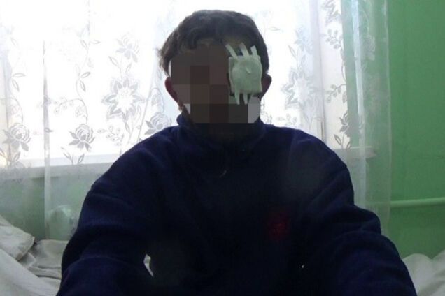 Террорист ДНР