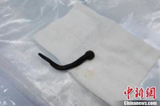 П\u0027явка, медицина