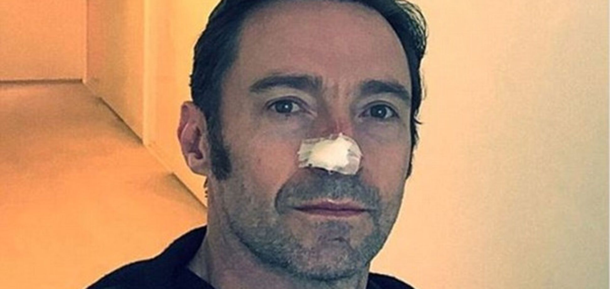 Хью Джекман