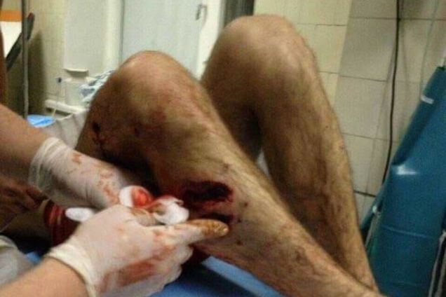 Бої під Авдіївкою