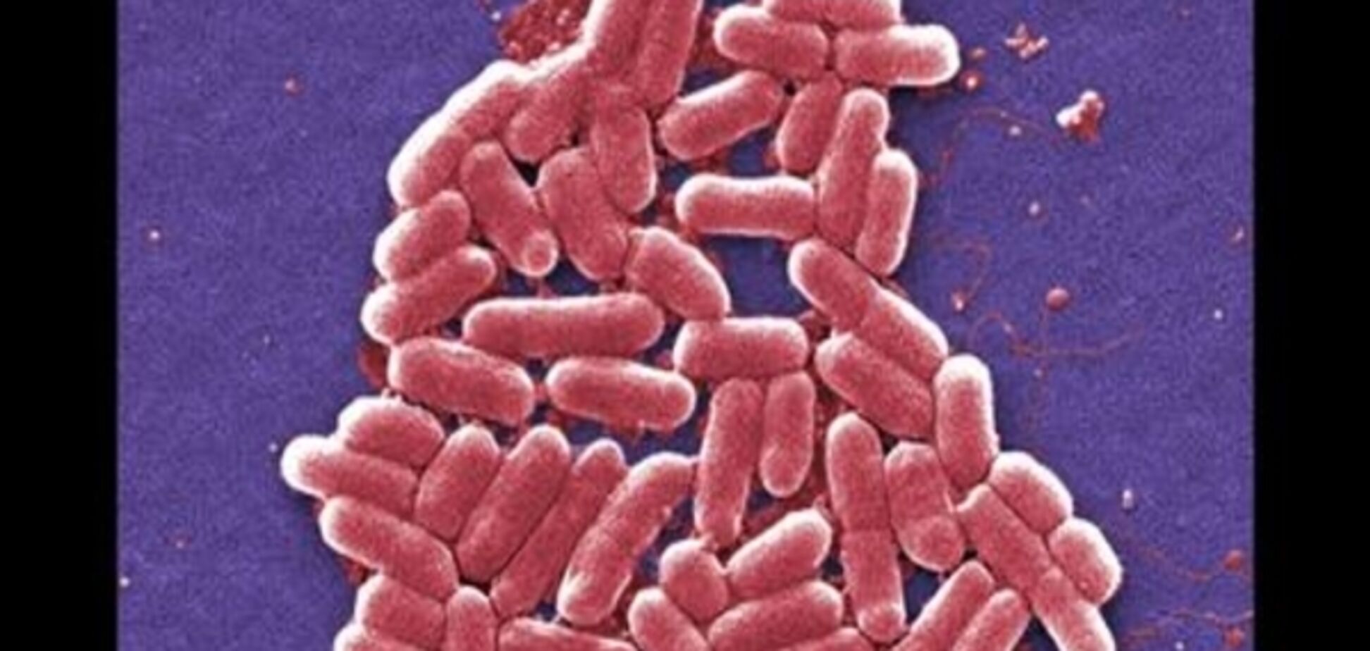 ВООЗ визначила 12 найнебезпечніших бактерій