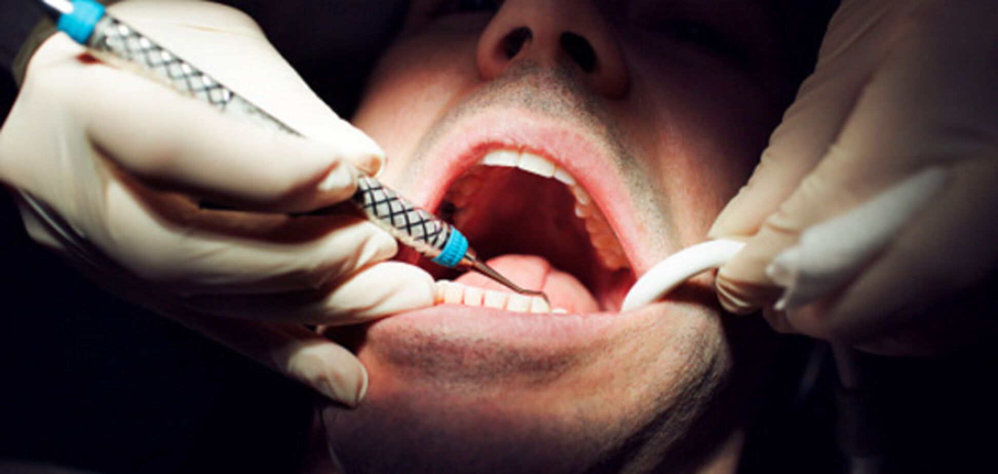 Срок за зуб: под Киевом стоматолога могут посадить за увечья пациенту