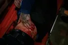 пострадавший