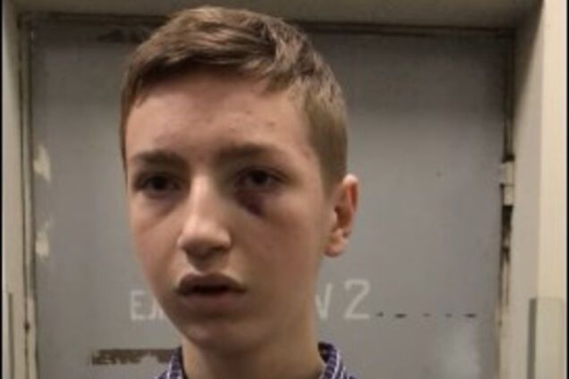 У Києві побили підлітка