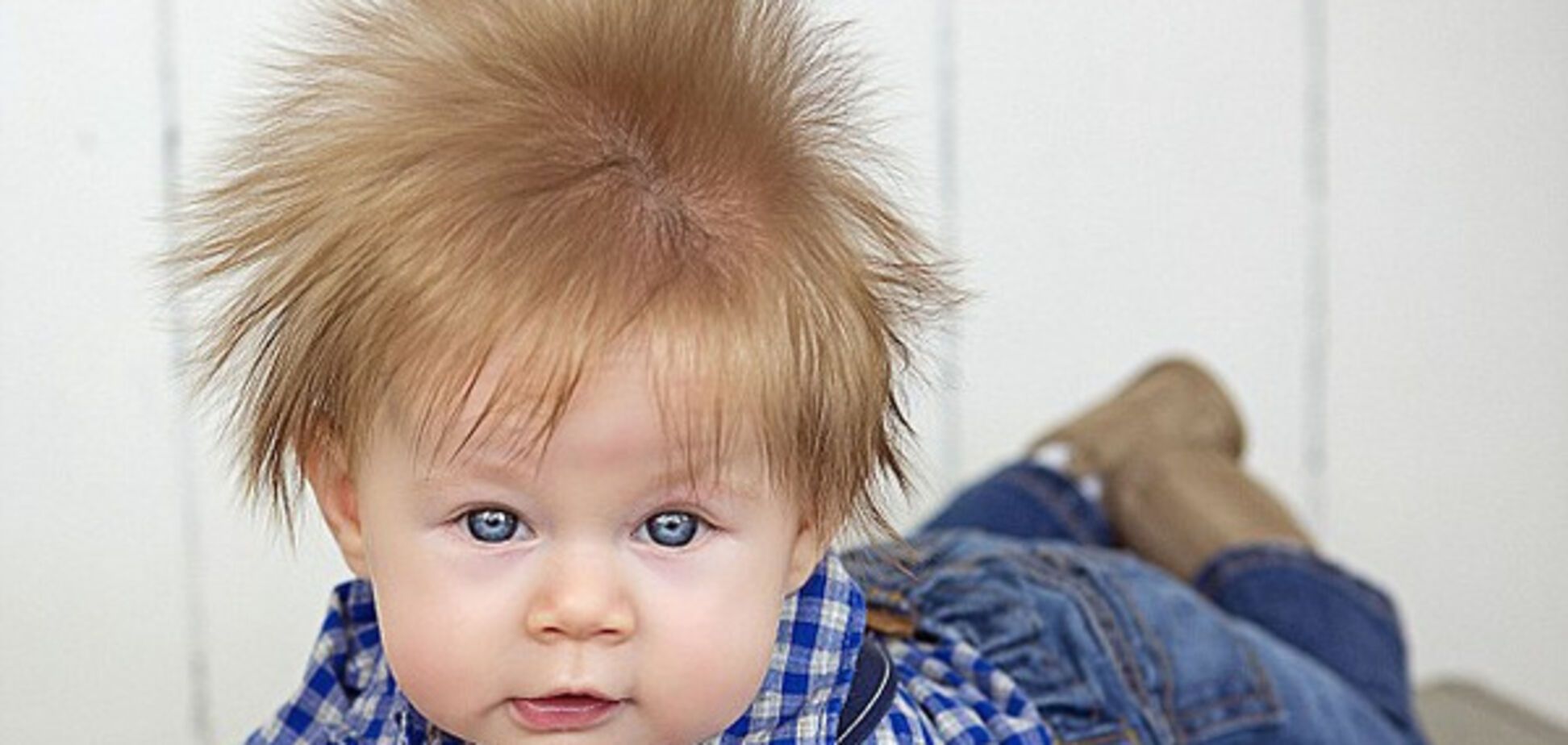 Неймовірна шевелюра: довге волосся малюка було видно навіть на УЗД