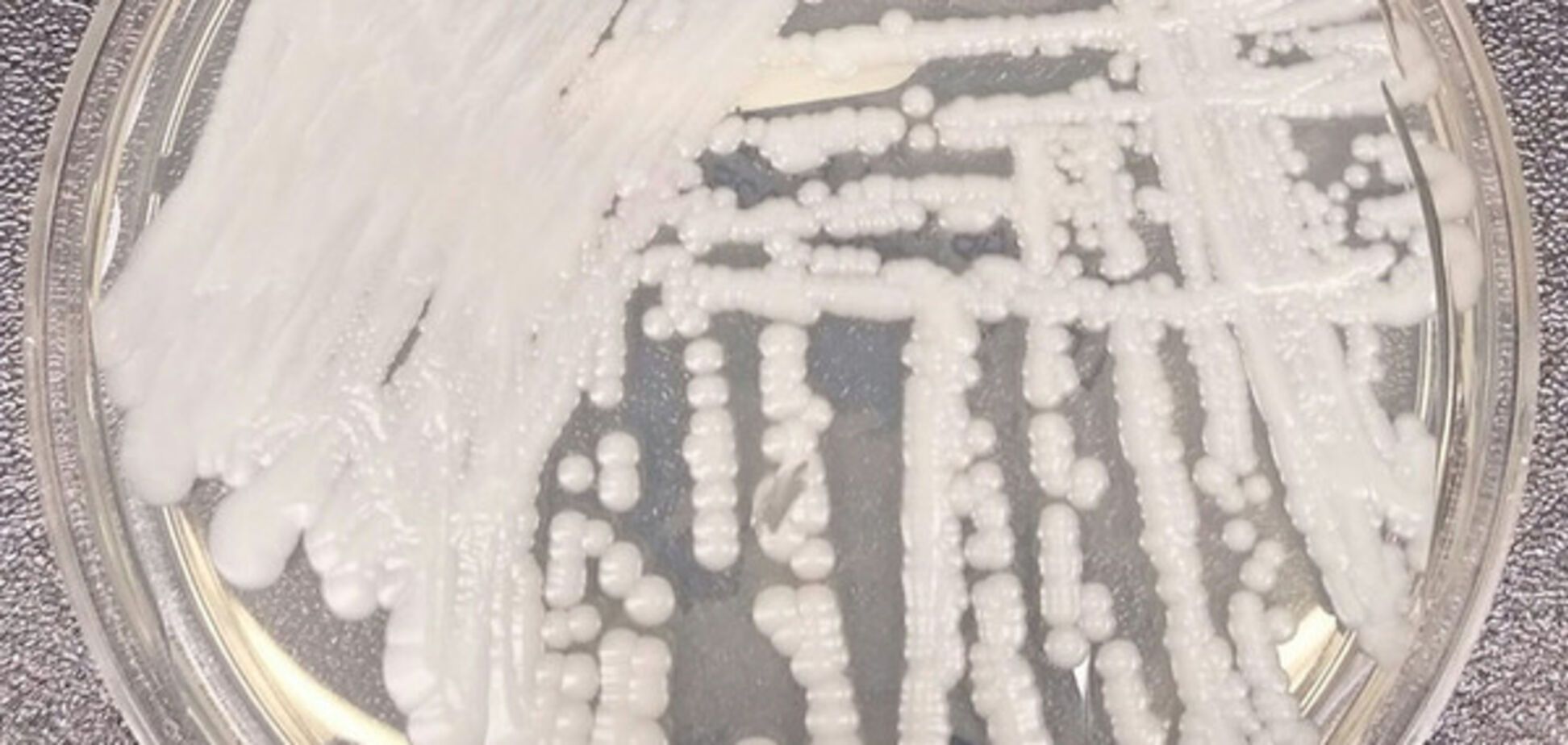 Candida auris