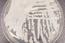 Candida auris