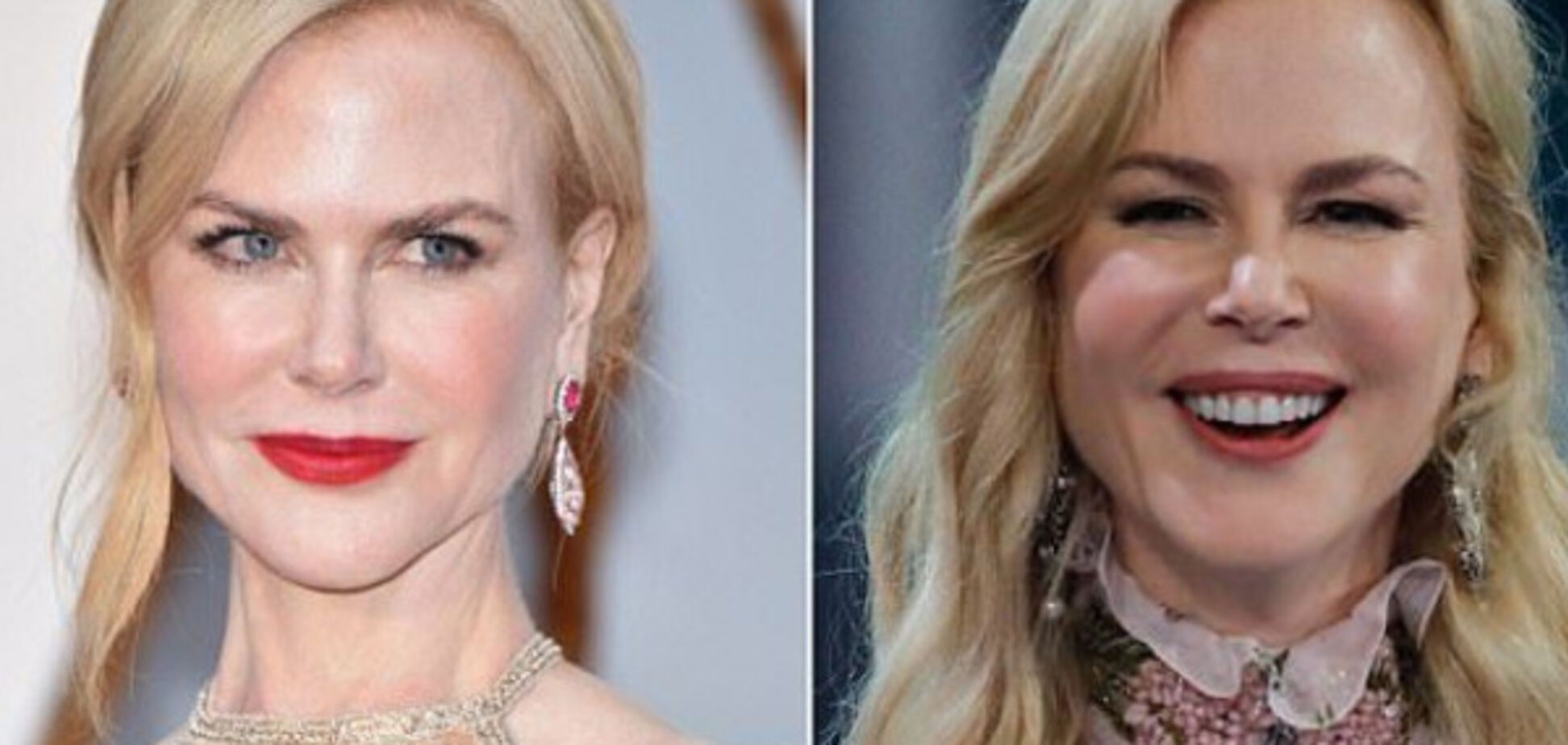 Николь Кидман