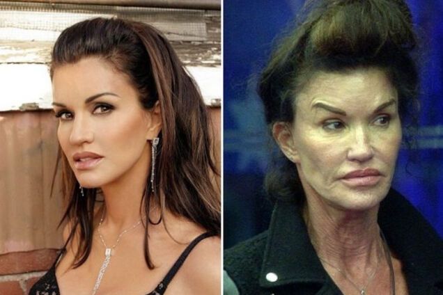 Дженис Дикинсон